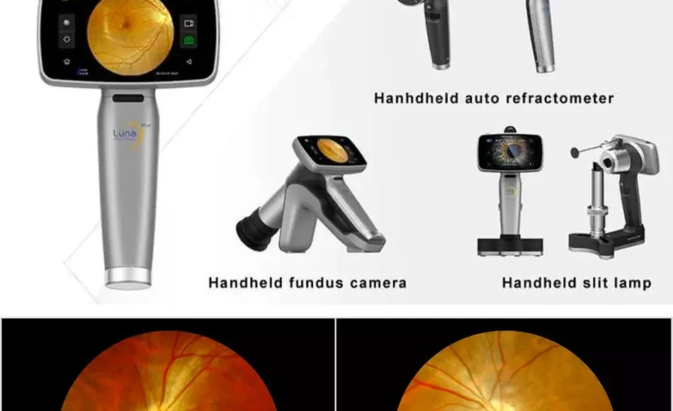 HFC-2 Portable Mydriatic Handheld Digital Second Generation Autofocus Fundus Camera Optical Ophthalmology Medical Instruments